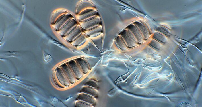 Westerdijk Fungal Biodiversity Institute Fungal Identification and Strain Typing